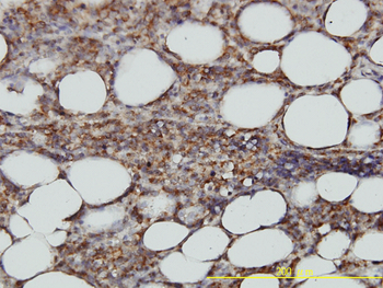 STX6 monoclonal antibody (M01), clone 1G2
