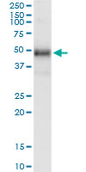 TRIB1 monoclonal antibody (M01), clone 4A10