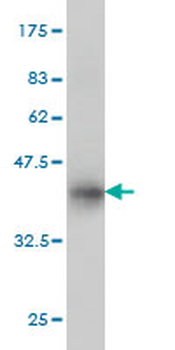 TRIB1 monoclonal antibody (M01), clone 4A10