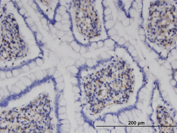 MPHOSPH9 monoclonal antibody (M10), clone 4E10