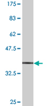 MPHOSPH9 monoclonal antibody (M10), clone 4E10