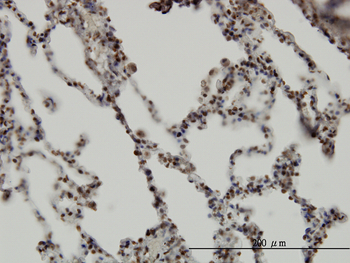 RBM5 monoclonal antibody (M01), clone 2B6
