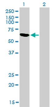 RBM5 monoclonal antibody (M01), clone 2B6