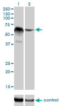 RBM5 monoclonal antibody (M01), clone 2B6
