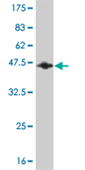 RBM5 monoclonal antibody (M01), clone 2B6