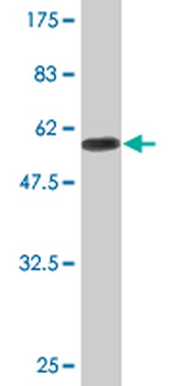 DHRS9 monoclonal antibody (M05), clone 3C6