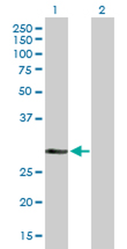 DHRS9 purified MaxPab mouse polyclonal antibody (B01P)