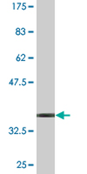 TSPAN1 monoclonal antibody (M05), clone 3B4