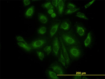 ACTR3 monoclonal antibody (M02), clone 2B6