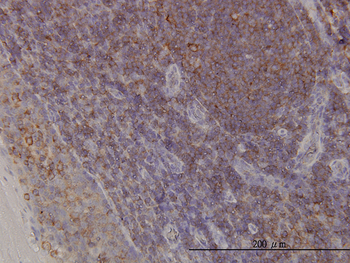 ACTR3 monoclonal antibody (M02), clone 2B6