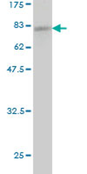 ACTR3 monoclonal antibody (M02), clone 2B6
