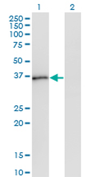 PQBP1 monoclonal antibody (M01), clone 1A11