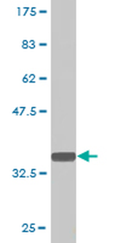 PQBP1 monoclonal antibody (M01), clone 1A11
