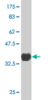 ATP9A monoclonal antibody (M02), clone 3G2