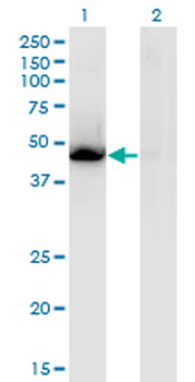 NR1H3 monoclonal antibody (M08), clone 3E9