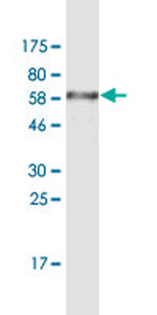 NR1H3 monoclonal antibody (M08), clone 3E9