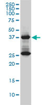 DNAJB6 monoclonal antibody (M01), clone 2C11-C1