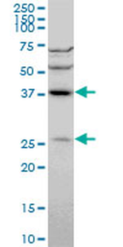 DNAJB6 monoclonal antibody (M01), clone 2C11-C1