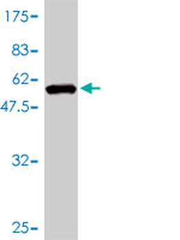 DNAJB6 monoclonal antibody (M01), clone 2C11-C1
