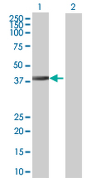 DNAJB6 MaxPab mouse polyclonal antibody (B01)