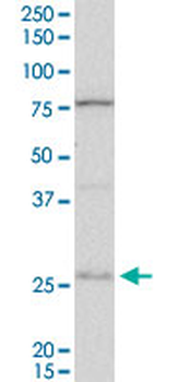 DNAJB6 polyclonal antibody (A01)