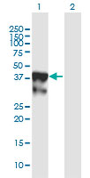 DNAJB6 polyclonal antibody (A01)