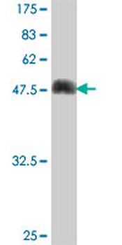 DNAJB6 polyclonal antibody (A01)