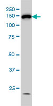 HDAC6 monoclonal antibody (M01), clone 1E2