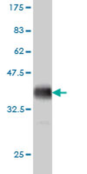 HDAC6 monoclonal antibody (M01), clone 1E2