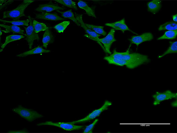 CCS monoclonal antibody (M03), clone 1E2