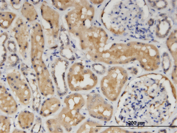CCS monoclonal antibody (M03), clone 1E2