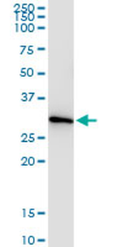CCS monoclonal antibody (M03), clone 1E2