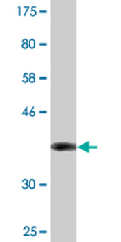 CCS monoclonal antibody (M03), clone 1E2