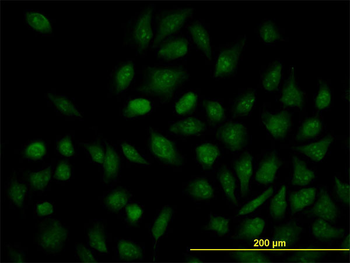 NR1H4 monoclonal antibody (M02), clone 1B10