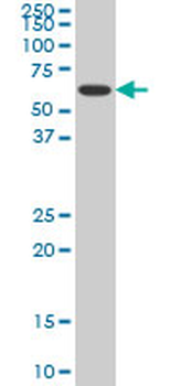 NR1H4 monoclonal antibody (M02), clone 1B10