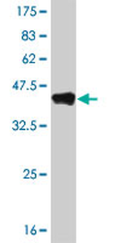 NR1H4 monoclonal antibody (M02), clone 1B10