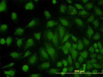 MVP monoclonal antibody (M01), clone 2H3-1A6