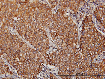 MVP monoclonal antibody (M01), clone 2H3-1A6