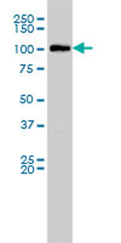 MVP monoclonal antibody (M01), clone 2H3-1A6