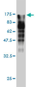 MVP monoclonal antibody (M01), clone 2H3-1A6