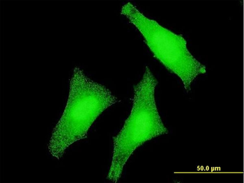 USP3 monoclonal antibody (M01), clone 1H2