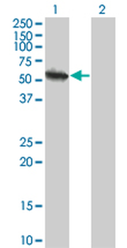USP3 monoclonal antibody (M01), clone 1H2