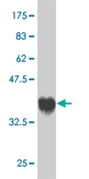 USP3 monoclonal antibody (M01), clone 1H2