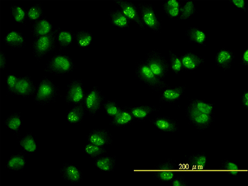 USP15 monoclonal antibody (M01), clone 1C10
