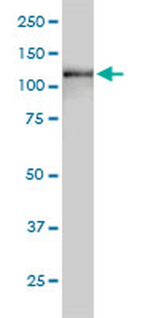 USP15 monoclonal antibody (M01), clone 1C10