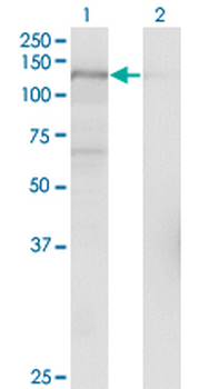 USP15 monoclonal antibody (M01), clone 1C10