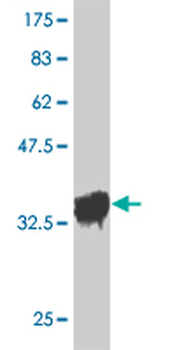 OXSR1 monoclonal antibody (M10), clone 3F6