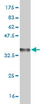OXSR1 monoclonal antibody (M06), clone 1C8
