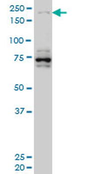 HELZ monoclonal antibody (M02), clone 5B2