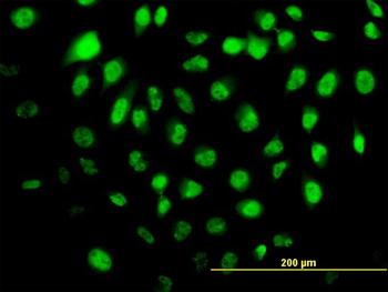 HELZ monoclonal antibody (M02), clone 5B2
